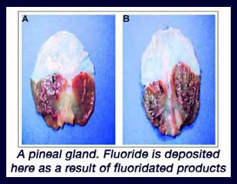 pineal_fluoride.jpg